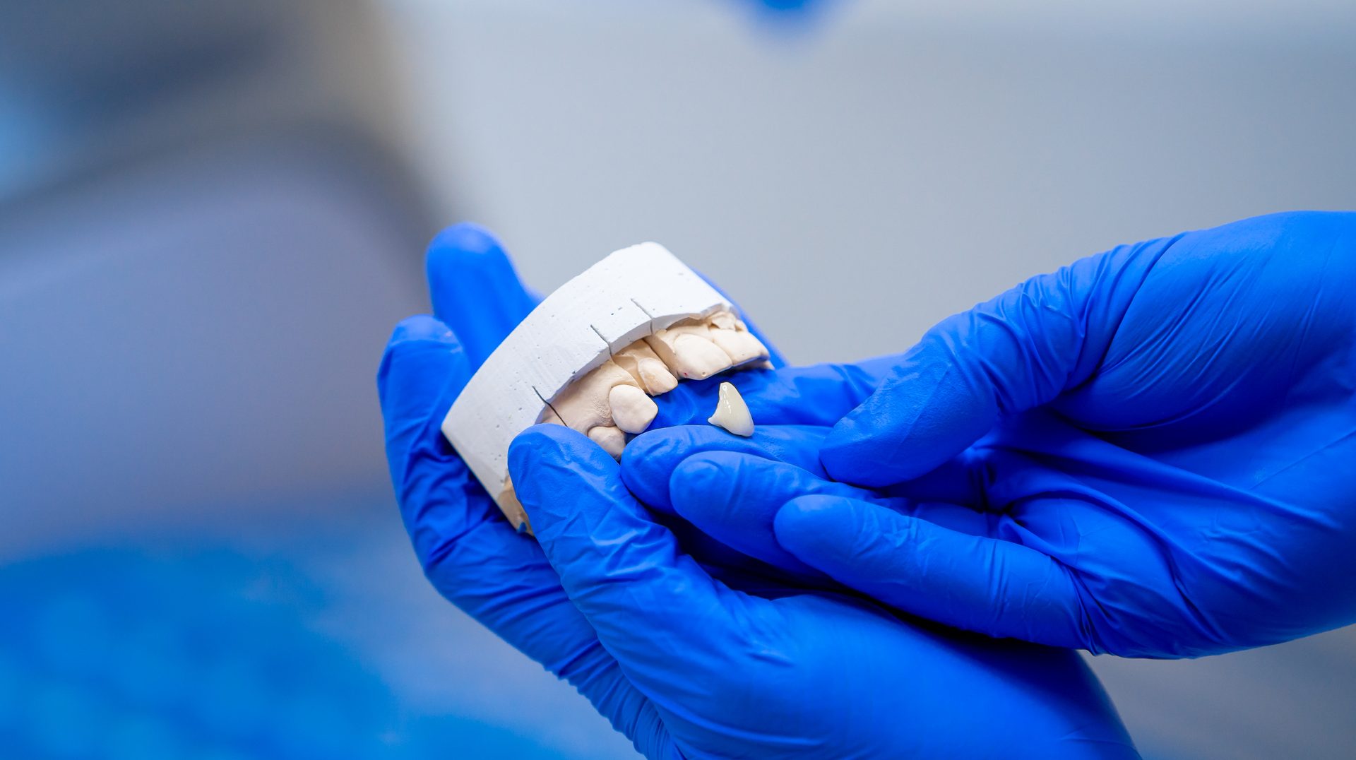 Close up Implant model tooth support fix bridge implant and crown. Dental Jaw. Teaching teeth model in doctor's hands. False tooth. Closeup..