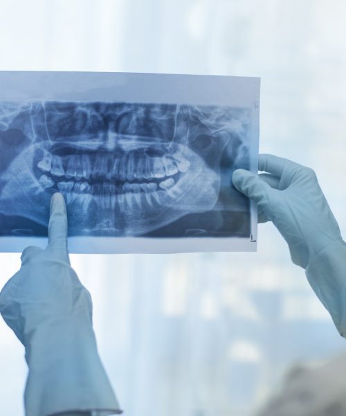 Female dentist holding a dental X-Ray